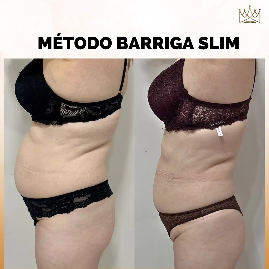 Método Barriga Slim